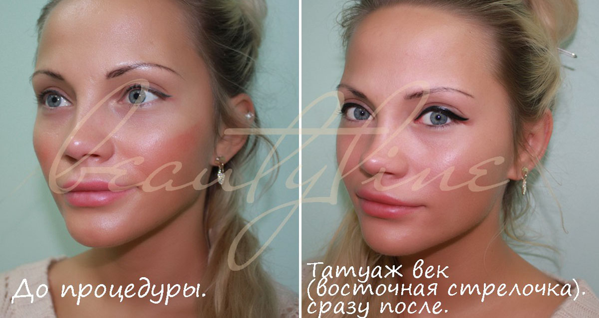 Красные родинки на теле: причины. Виды родинок Красные пятна на теле - m