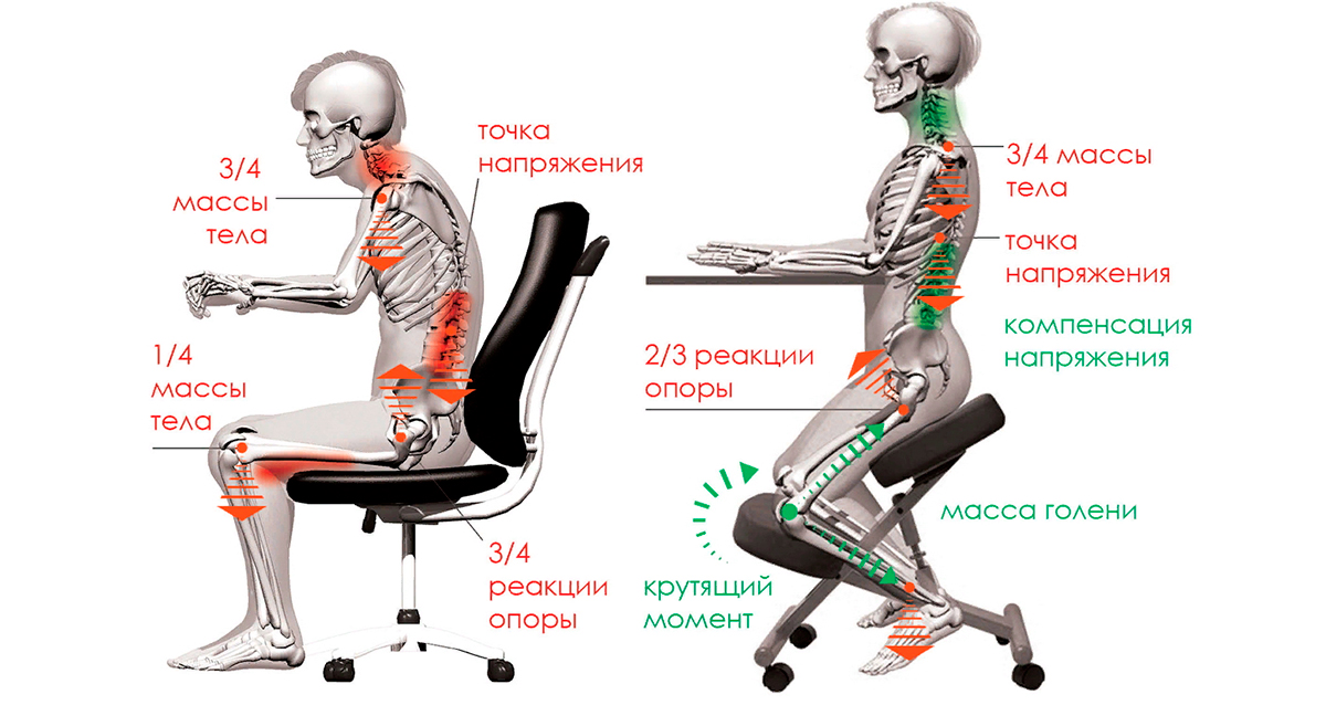 ортопедический коленный стул