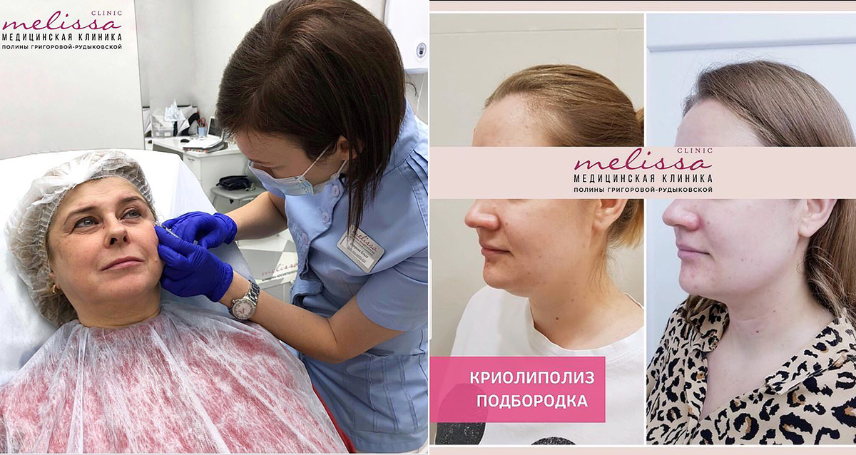 клиника косметологии мелисса